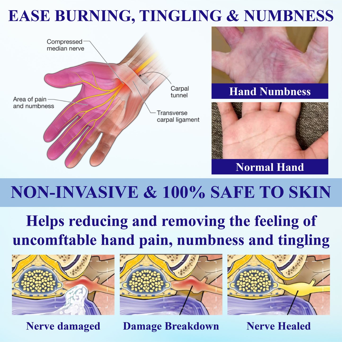 ATTDX® NumbAway CoolEase Neuropathy Spray