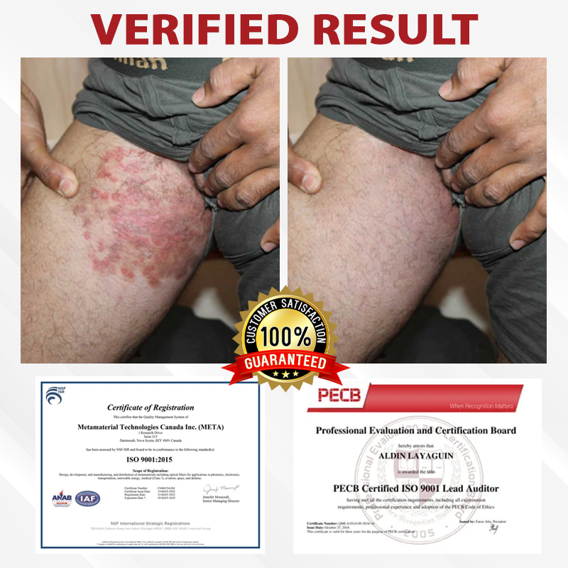 ATTDX® PowerRelief Men’s HPV Care Spray