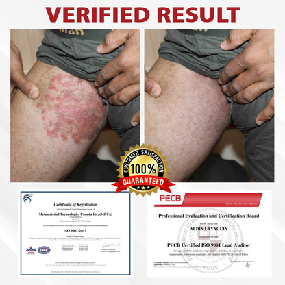 ATTDX® PowerRelief Men’s HPV Care Spray