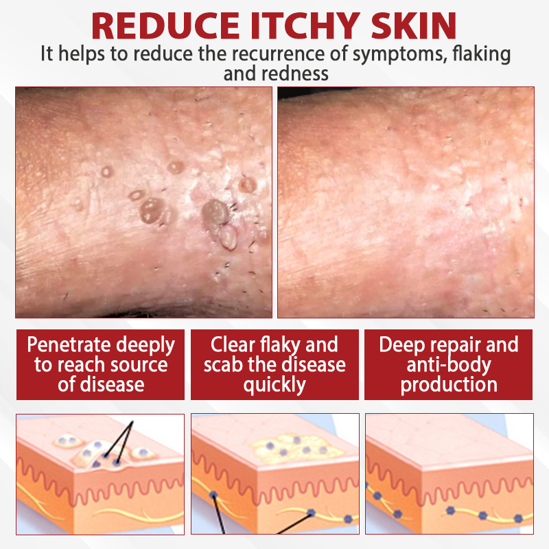 ATTDX® PowerRelief Men’s HPV Care Spray