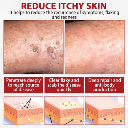 ATTDX® PowerRelief Men’s HPV Care Spray