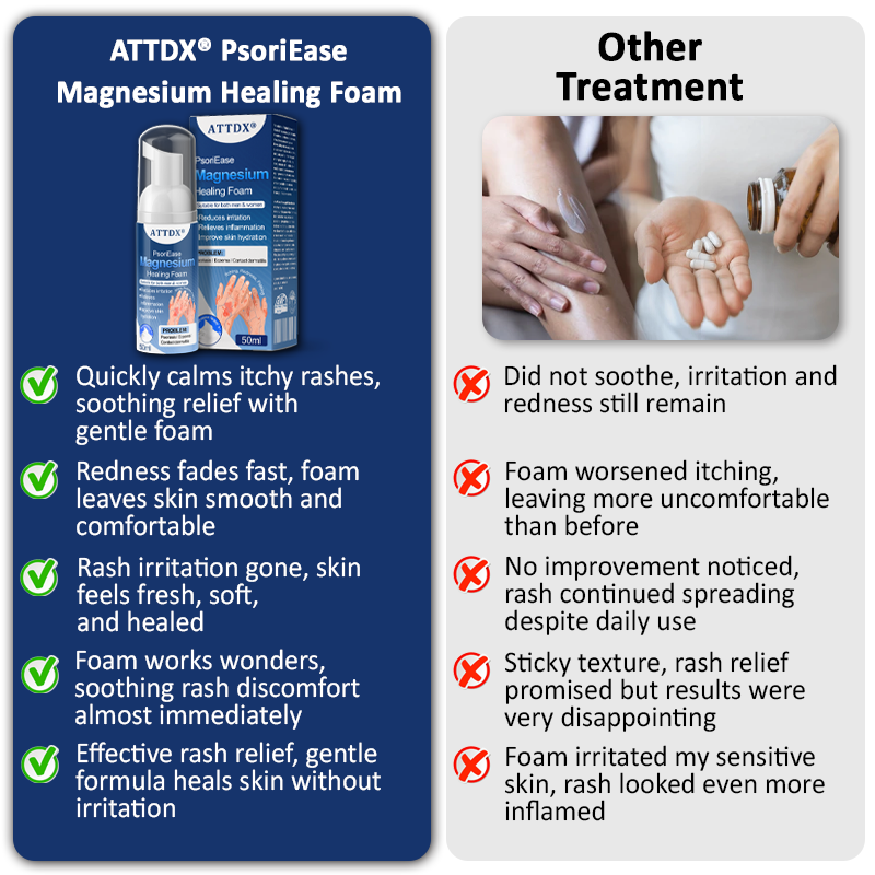ATTDX® PsoriEase Magnesium Healing Foam