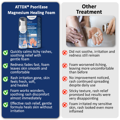 ATTDX® PsoriEase Magnesium Healing Foam