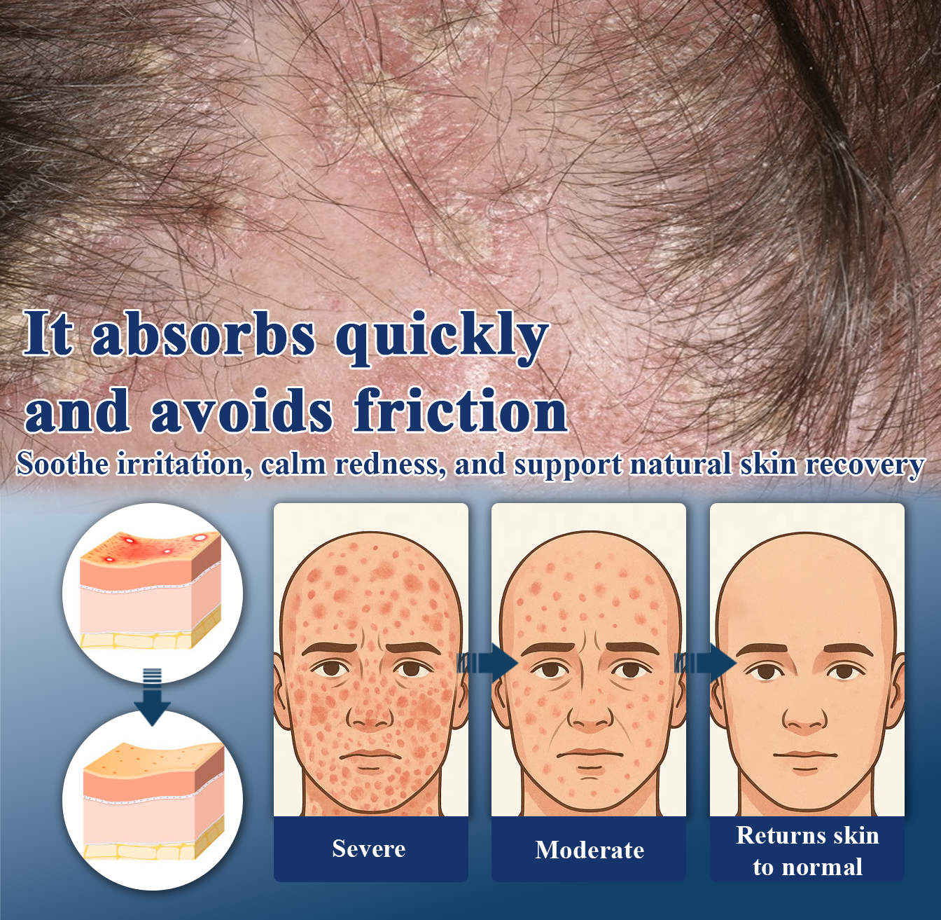 ATTDX® PsoriEase Magnesium Healing Foam