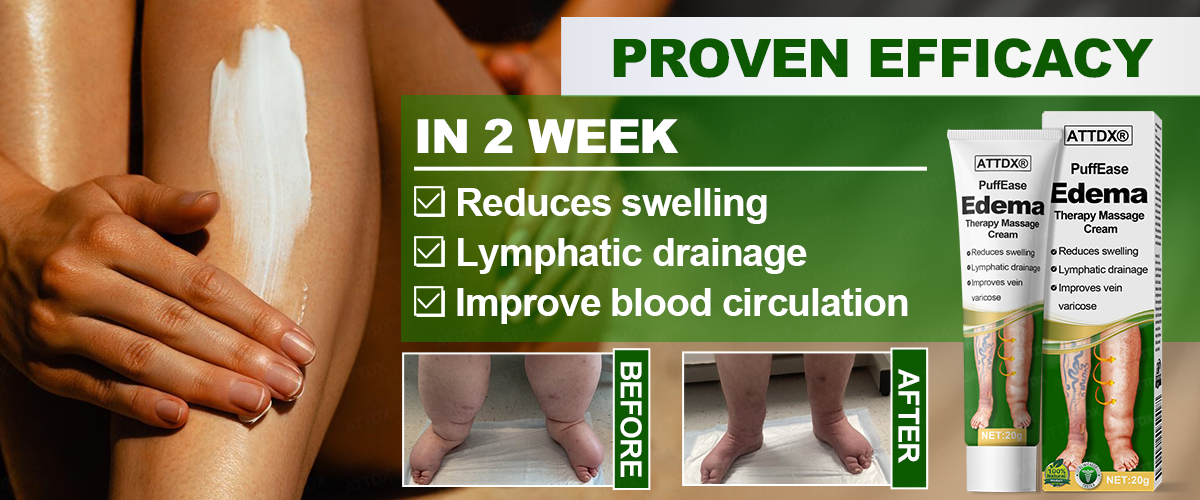 ATTDX® PuffEase Edema Therapy Massage Cream 8 ATTDX® PuffEase Edema Therapy Massage Cream