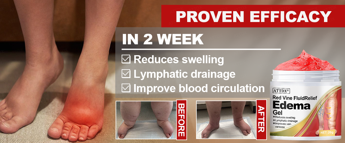 ATTDX® Red Vine FluidRelief Edema Gel 22 ATTDX® Red Vine FluidRelief Edema Gel