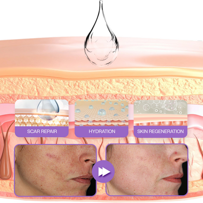 ATTDX® RevivaDerma Face & Body Scar Gel - Clinically proven to flatten and fade surgical scars, acne marks, burns, and trauma-related scars