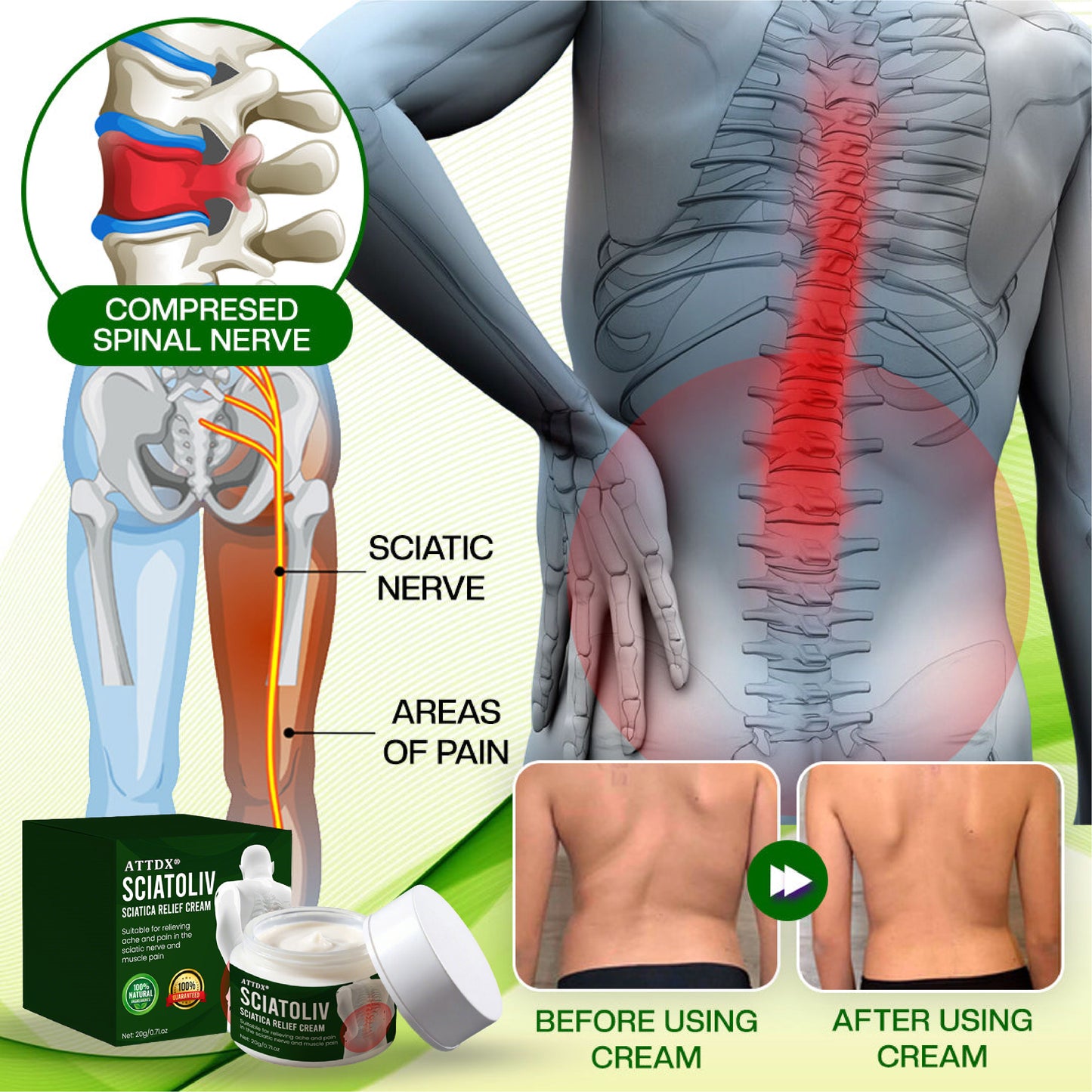 ATTDX® Sciatoliv Sciatica Relief Cream