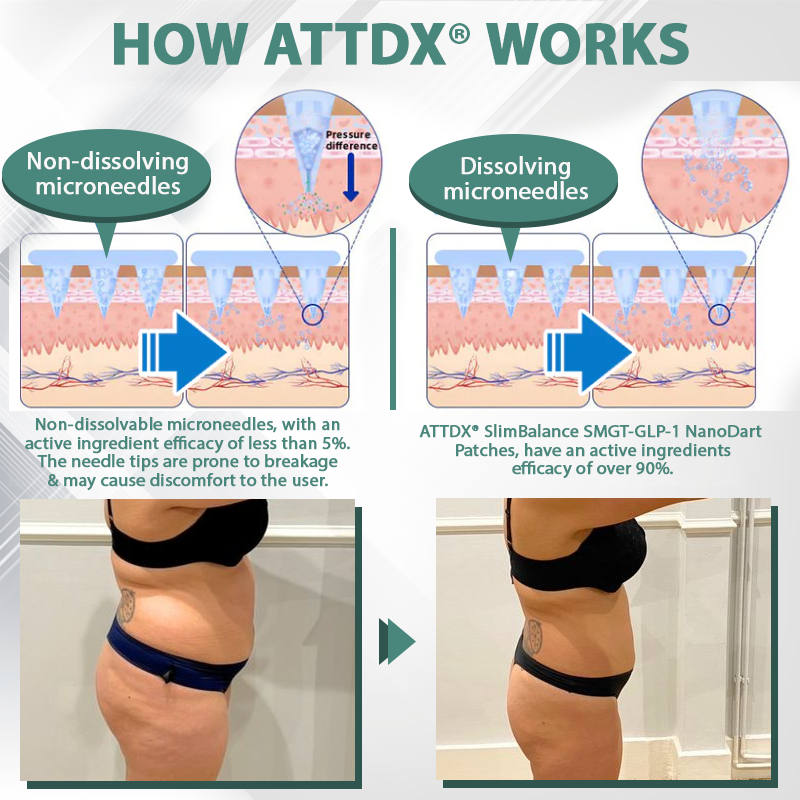 ATTDX® SlimBalance SMGT-GLP-1 NanoDart Patches 27 ATTDX® SlimBalance SMGT-GLP-1 NanoDart Patches