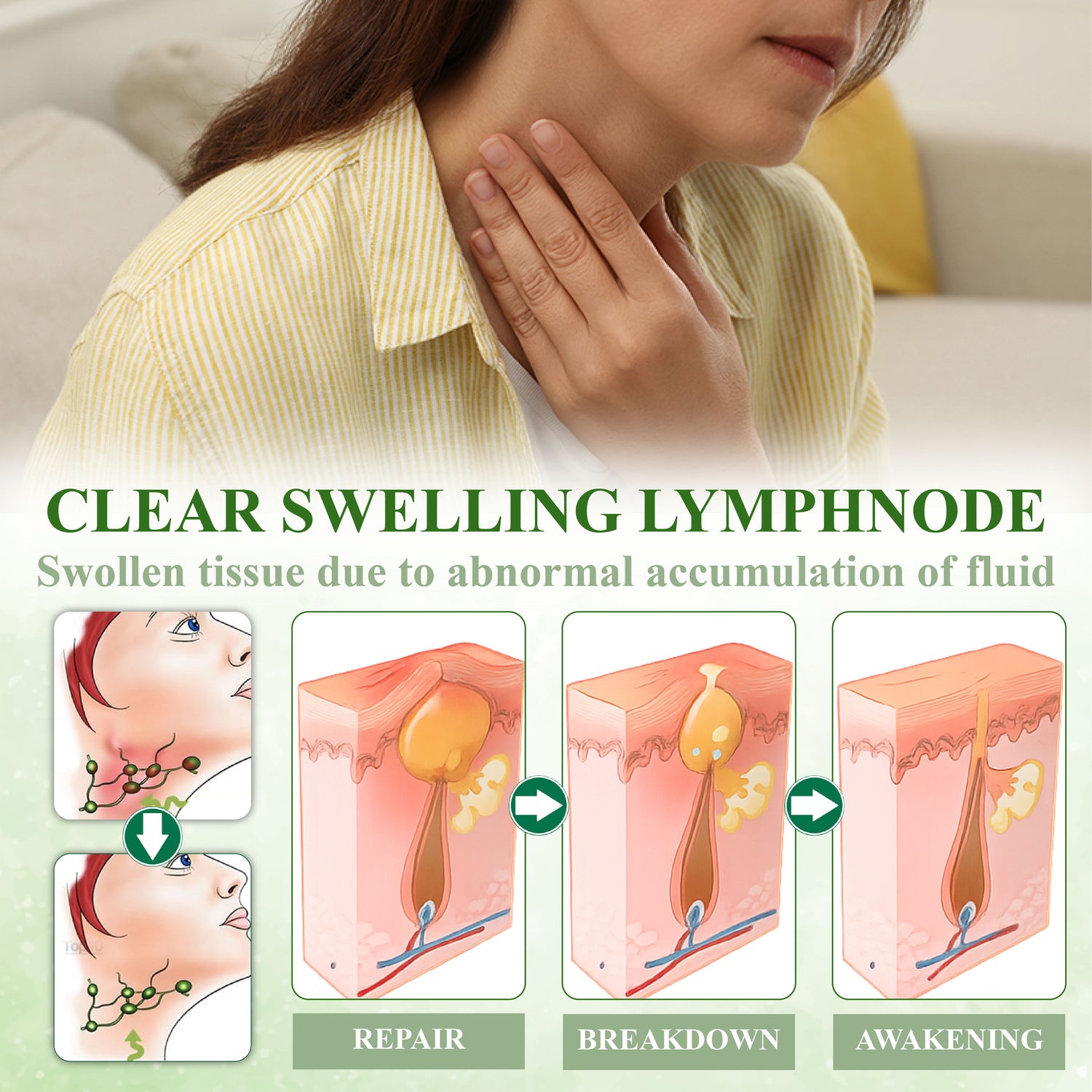 ATTDX SwellSootheLymphaticCream 05