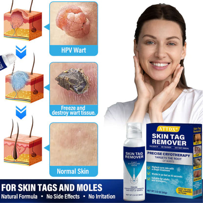 ATTDX® TagRecede Cryo Treatment Spray