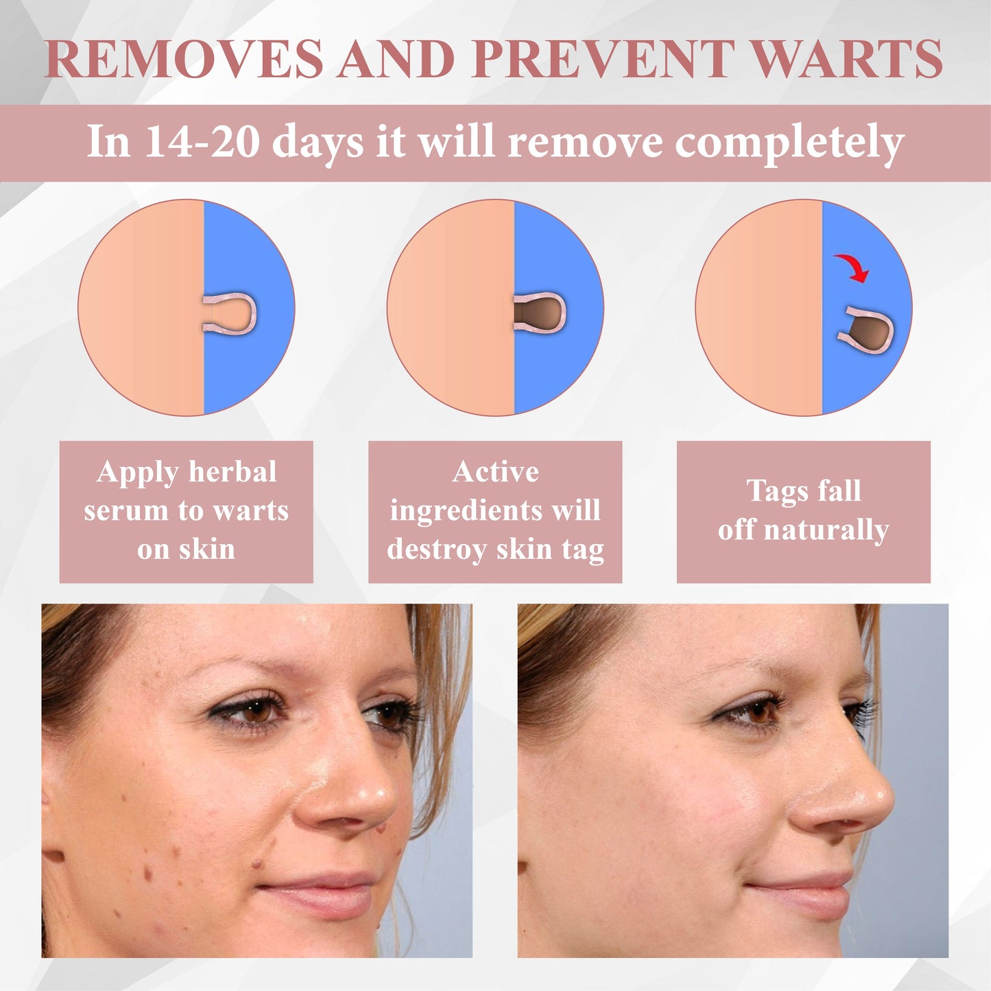ATTDX® Tag & Blemish Peel-Off Gel Wrapping Mask