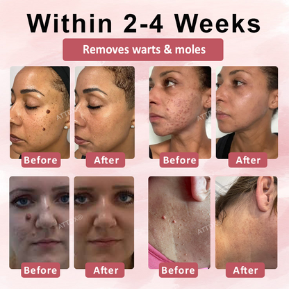 ATTDX® Tag & Blemish Peel-Off Gel Wrapping Mask