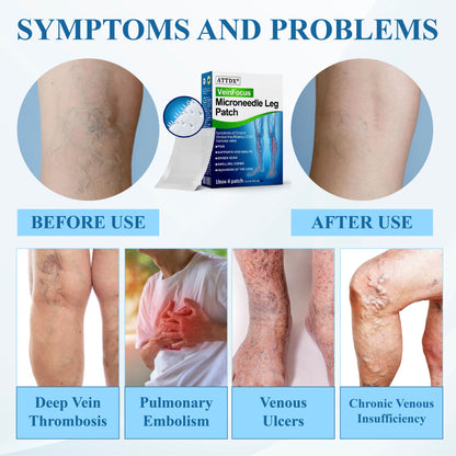 ATTDX® VeinFocus Microneedle Leg Patch