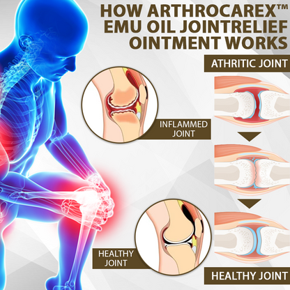 ArthroCareX™ Emu Oil JointRelief Ointment