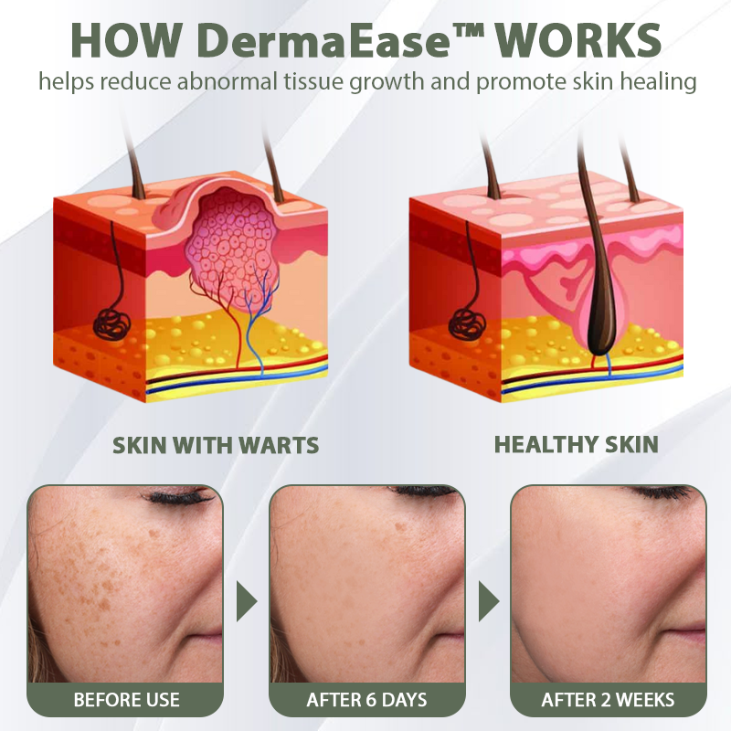 DermaEase™ Spotless Tag and WartRemoval Gel