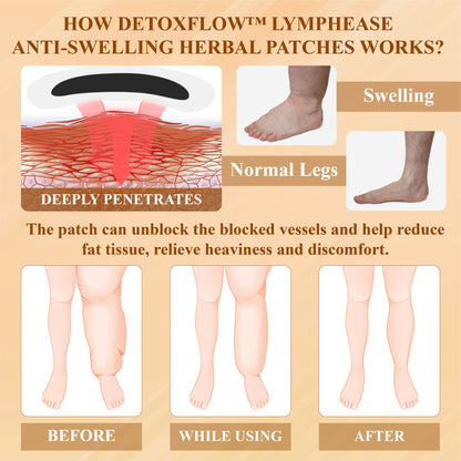 DetoxFlow™ LymphEase Anti-Swelling Herbal Patches