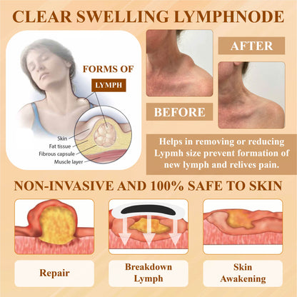 DetoxFlow™ LymphEase Anti-Swelling Herbal Patches