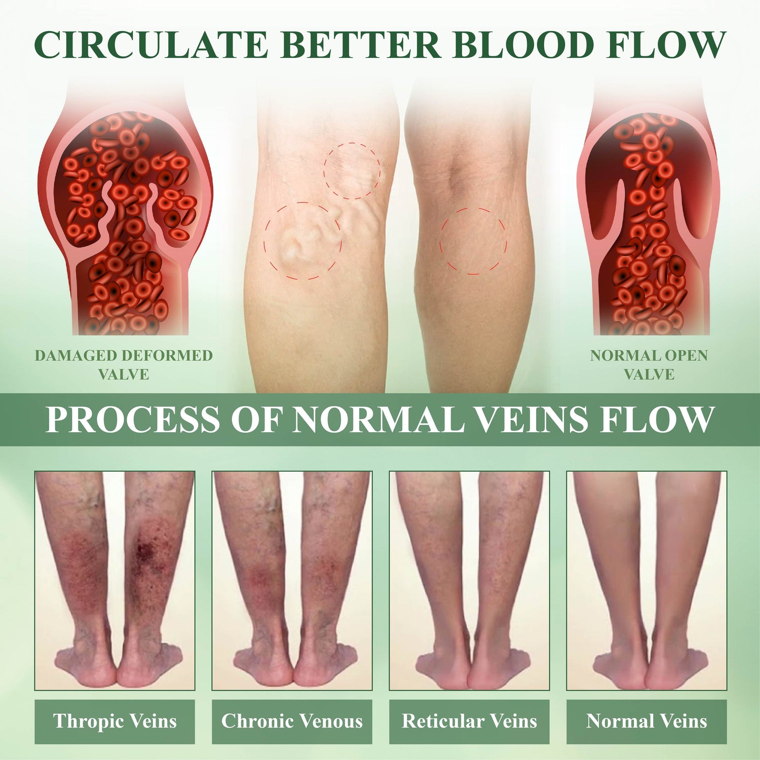 ATTDX® SwellSoothe Lymphatic Cream image ATTDX® SwellSoothe Lymphatic Cream