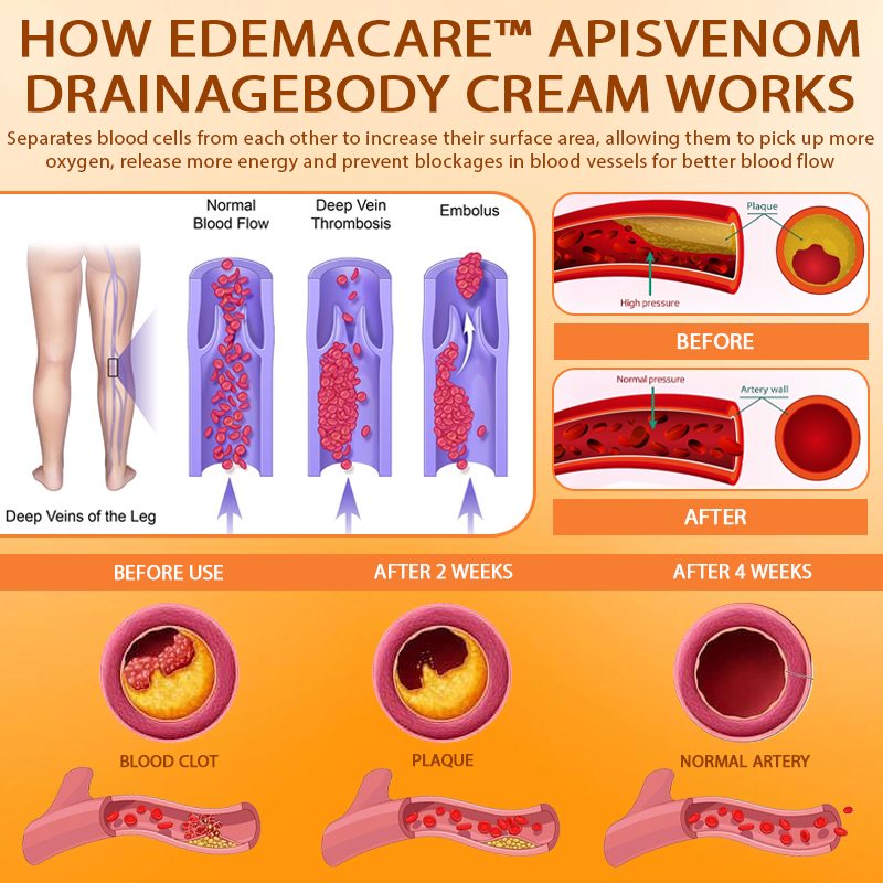 EdemaCare™ ApisVenom DrainageBody Cream