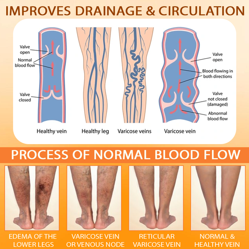 EdemaCare™ ApisVenom DrainageBody Cream