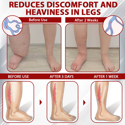 EdemaCare™ LymphDrain Horse Chestnut Massage Cream