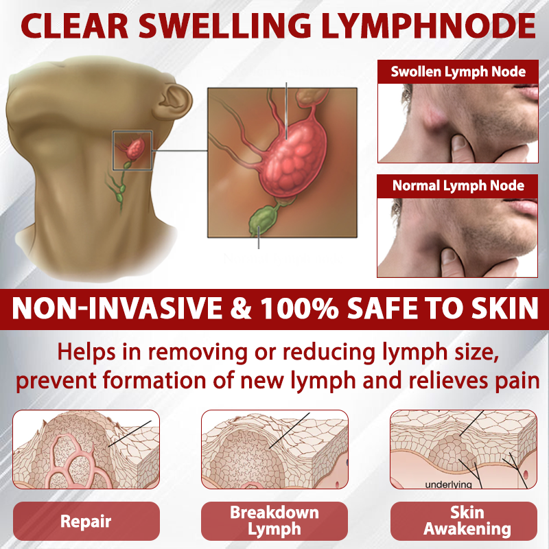 EdemaCare™ LymphDrain Horse Chestnut Massage Cream
