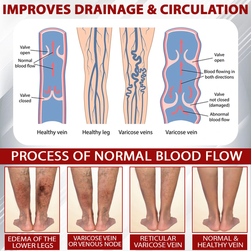 ATTDX® Red Vine FluidRelief Edema Gel 23 ATTDX® Red Vine FluidRelief Edema Gel
