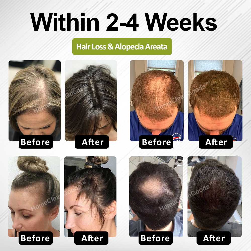 HomeCleanGoods™ RootBloom Hair Revival Serum