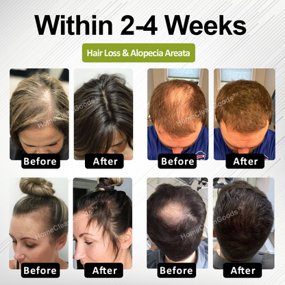HomeCleanGoods™ RootBloom Hair Revival Serum