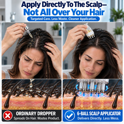 HomeCleanGoods™ RootRoll 6-Ball Precision Scalp Treatment Applicator