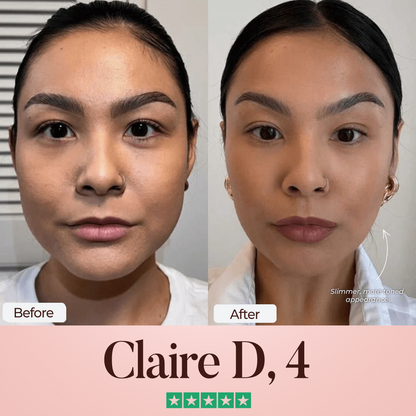 ATTDX® SculptFix Mask Infused with Retinol & Collagen 👩 Reveal Your Best Jawline