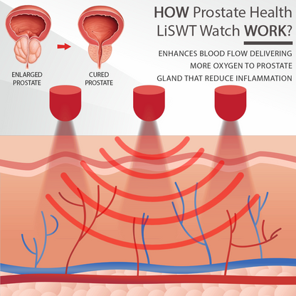 RICPIND™ Prostate Health LiSWT Watch