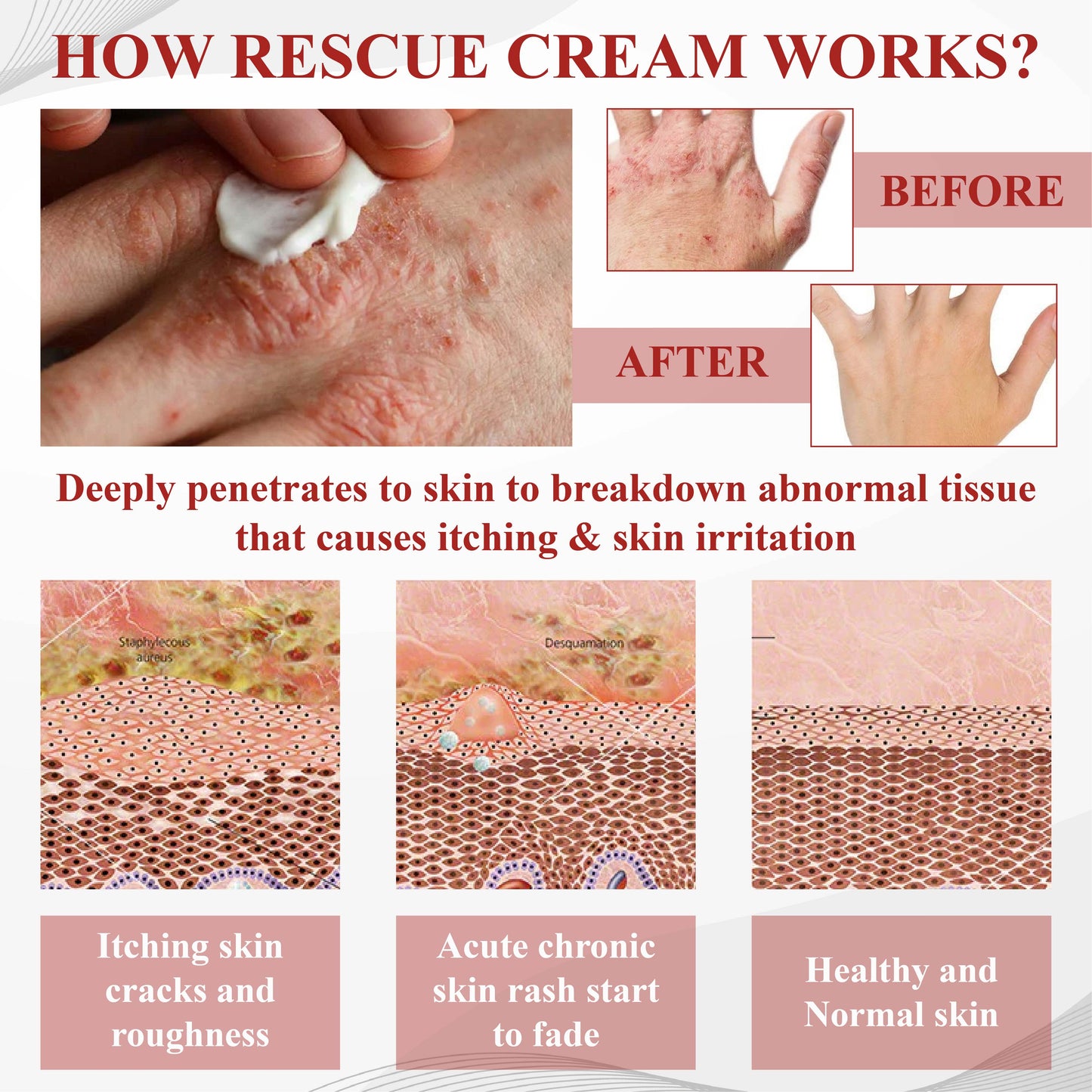 RelievaDerm™ Hydration Rescue Cream