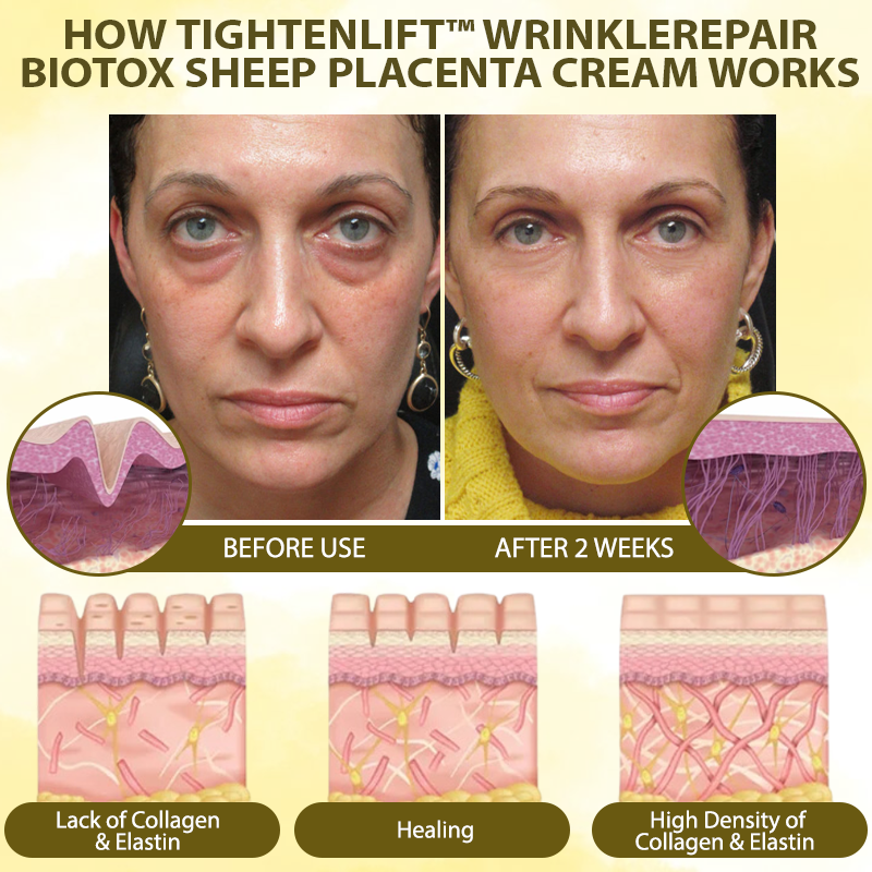 TightenLift™ WrinkleRepair BioTox Sheep Placenta Cream