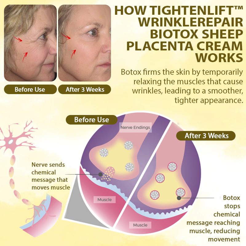 TightenLift™ WrinkleRepair BioTox Sheep Placenta Cream