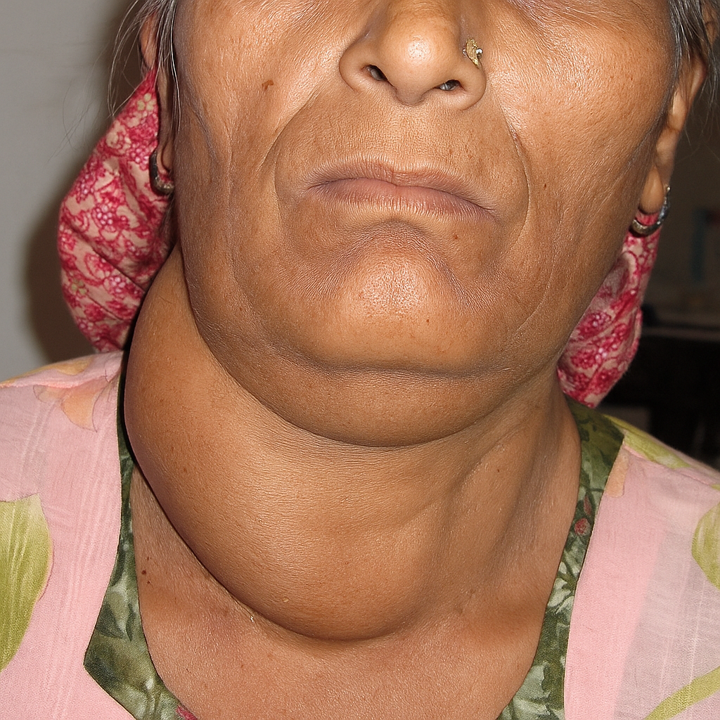 ATTDX® SwellSoothe Lymphatic Cream image ATTDX® SwellSoothe Lymphatic Cream